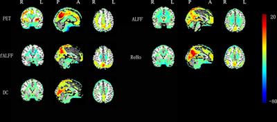 Frequency-Dependent Relationship Between Resting-State fMRI and Glucose Metabolism in the Elderly